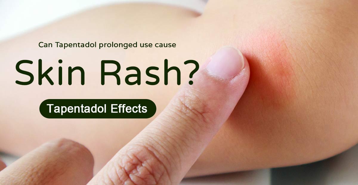 Can Tapentadol prolonged use cause skin rash? Tapentadol Effects